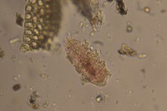 Echiniscidae