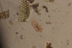 Echiniscidae