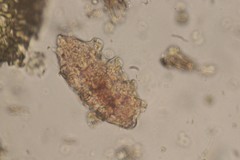 Echiniscidae