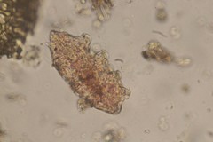 Echiniscidae
