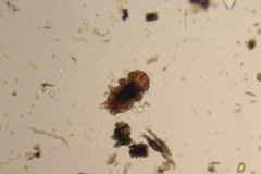 Echiniscidae