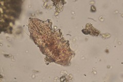 Echiniscidae