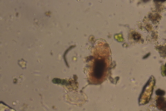 Echiniscidae