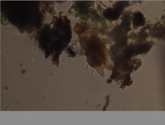 Echiniscidae