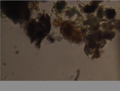 Echiniscidae