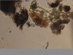 Echiniscidae