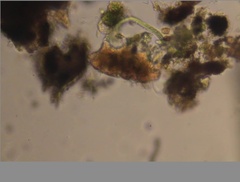 Echiniscidae