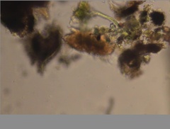 Echiniscidae