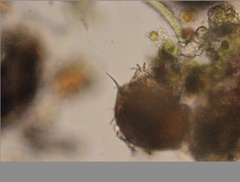 Echiniscidae
