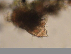 Echiniscidae