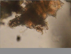 Echiniscidae