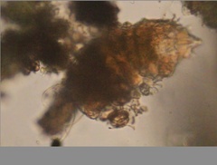 Echiniscidae