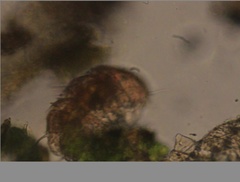Echiniscidae