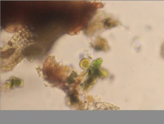Echiniscidae