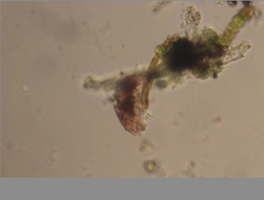Echiniscidae