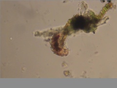 Echiniscidae