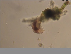 Echiniscidae