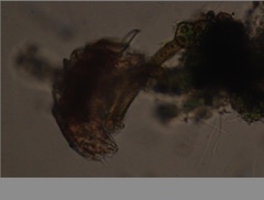Echiniscidae