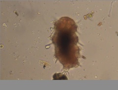 Echiniscidae