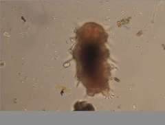 Echiniscidae