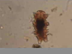 Echiniscidae