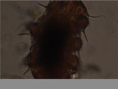 Echiniscidae