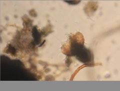 Echiniscidae