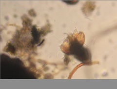 Echiniscidae