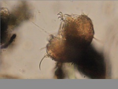 Echiniscidae