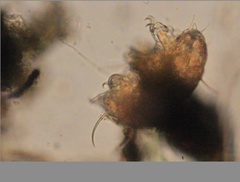 Echiniscidae