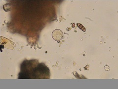 Echiniscidae