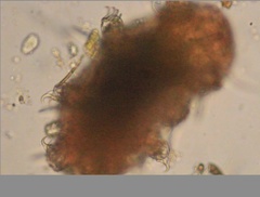 Echiniscidae