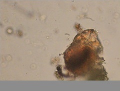 Echiniscidae