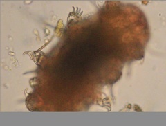 Echiniscidae