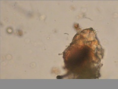 Echiniscidae