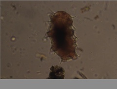 Echiniscidae