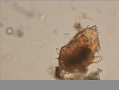 Echiniscidae