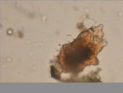 Echiniscidae