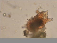 Echiniscidae