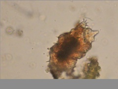 Echiniscidae