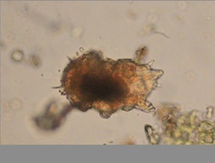 Echiniscidae