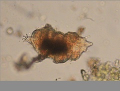Echiniscidae