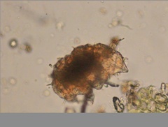Echiniscidae