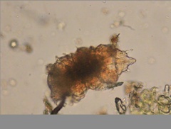 Echiniscidae