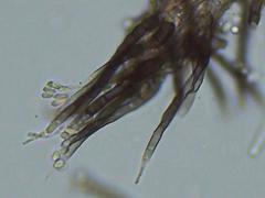 Pseudallescheria boydii