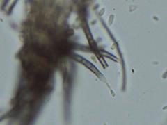 Pseudallescheria boydii