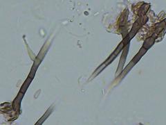 Pseudallescheria boydii