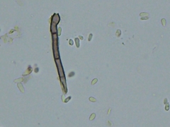 Pseudallescheria boydii