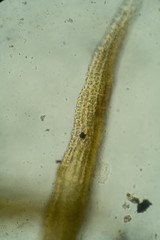 Racomitrium ericoides