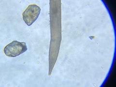 Hyalinonetrion elongatum